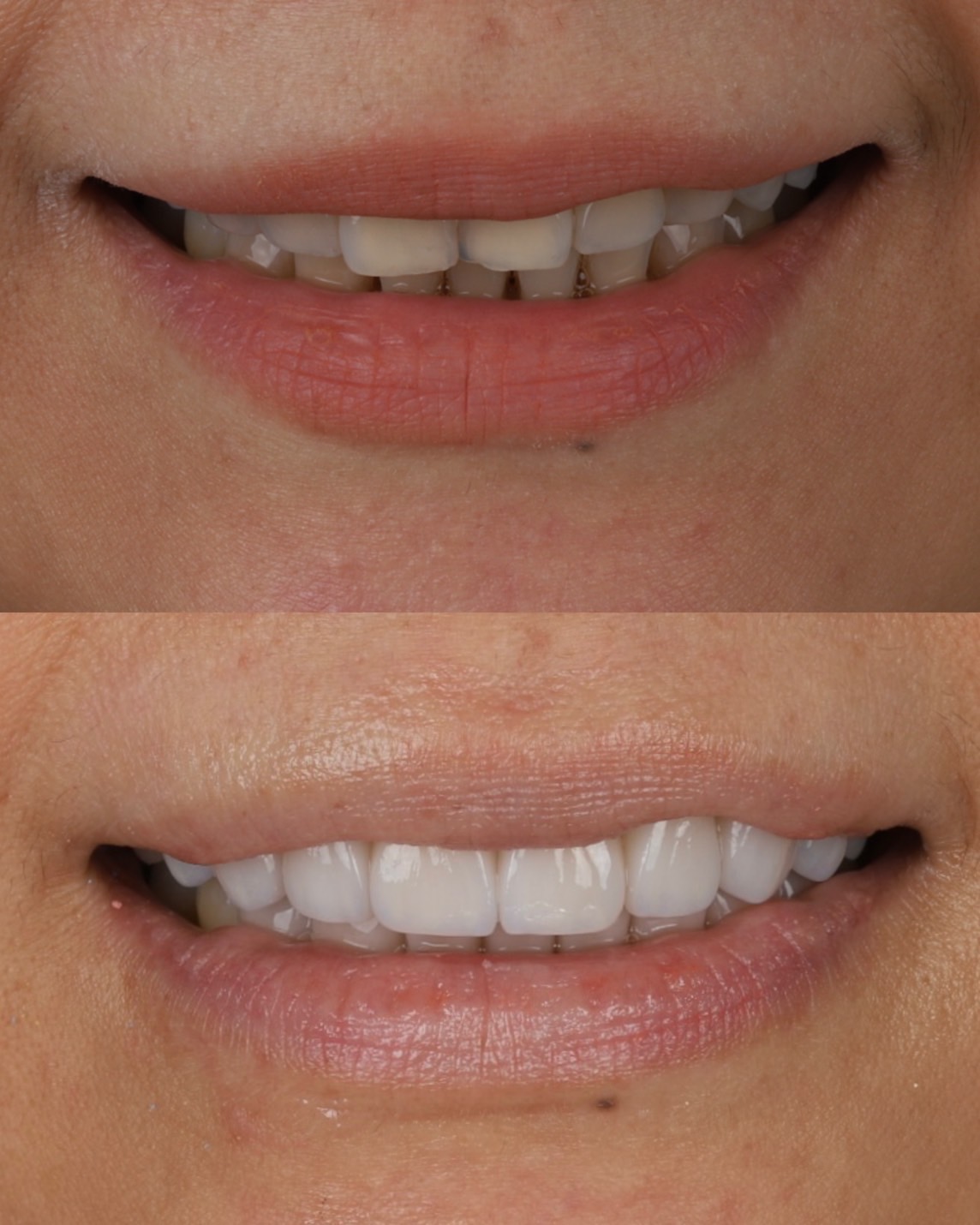 Before and After Case 4